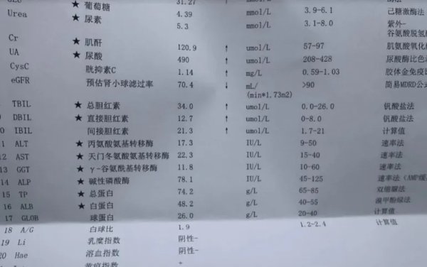 米配资 肌酐降不下去？医生提醒：不管这核心指标，吃药都白搭！